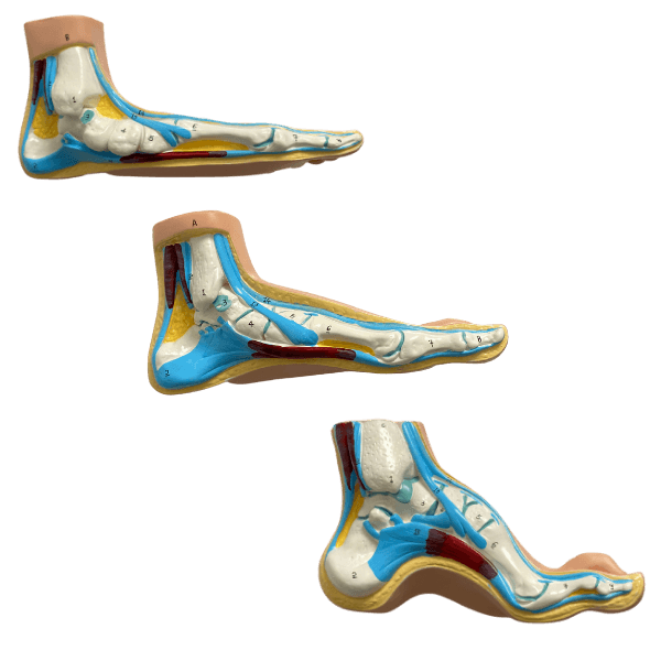Anatomical Flat, Normal, Arch Foot Model – LuxeMED