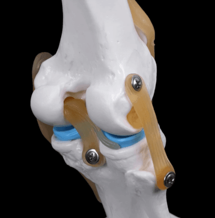 Anatomical Knee Model - LuxeMED